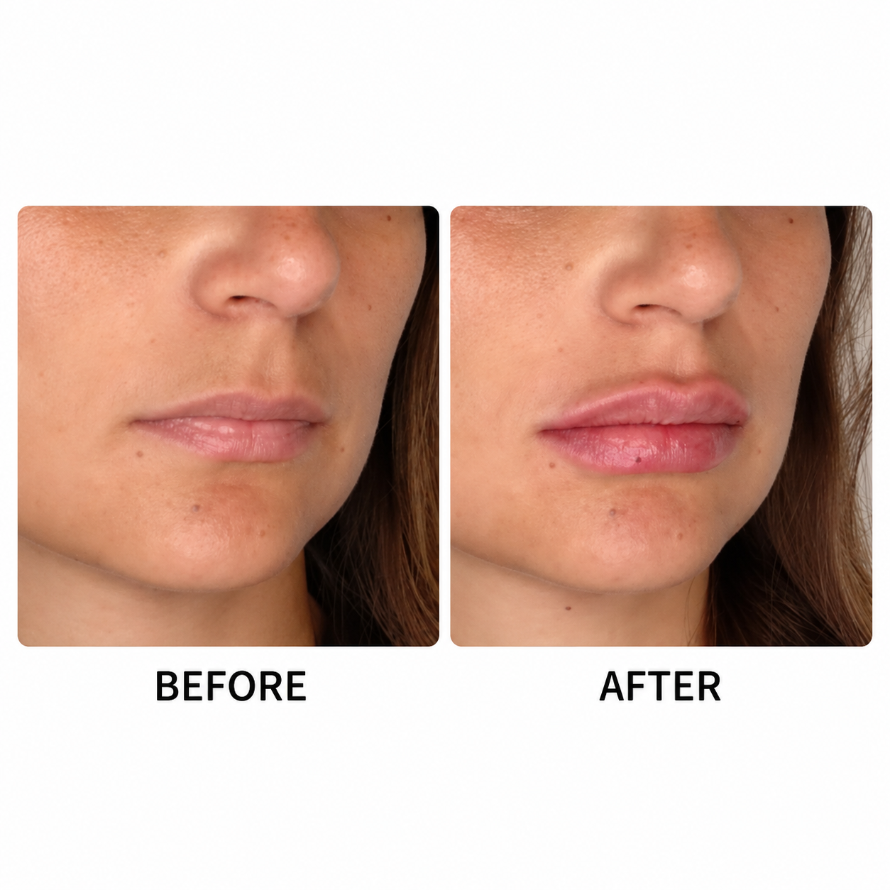 Before & After 3