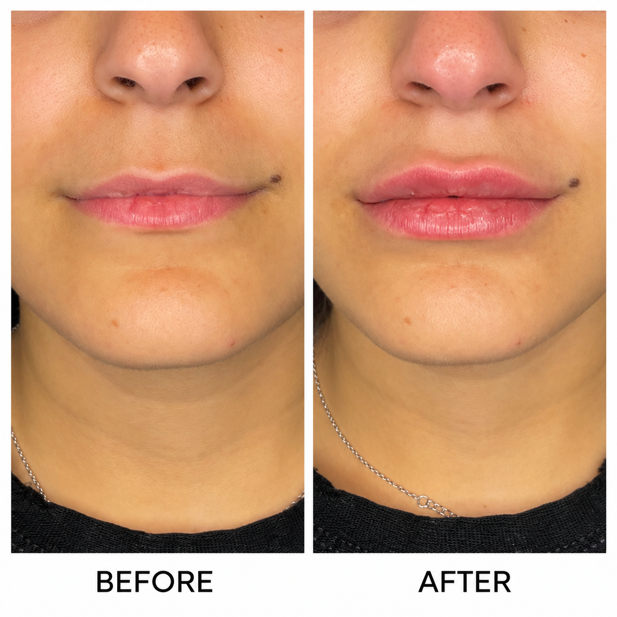 Before & After 2