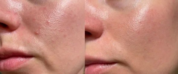 Before and after 1