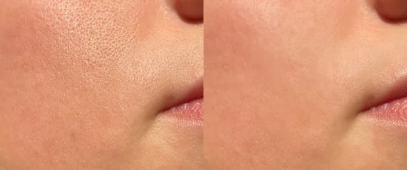 Before and after 2