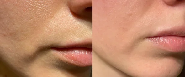 Before and after 3
