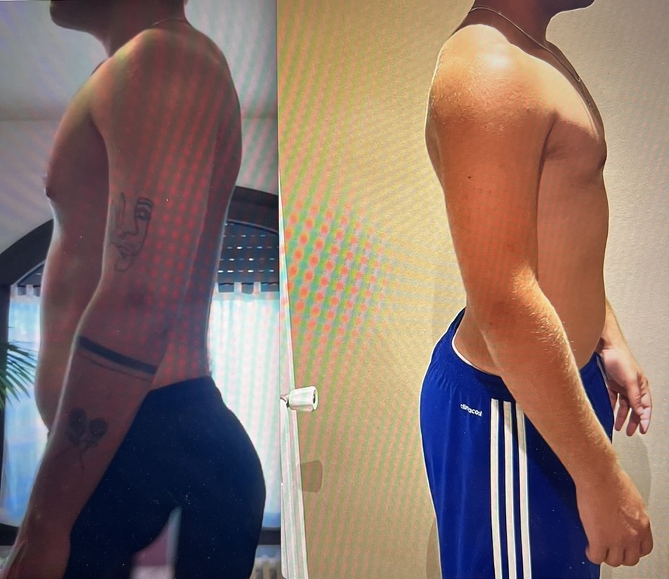Transformación antes y después 3