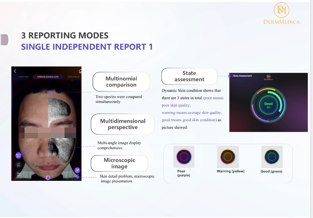 Three reporting modes with state assessment