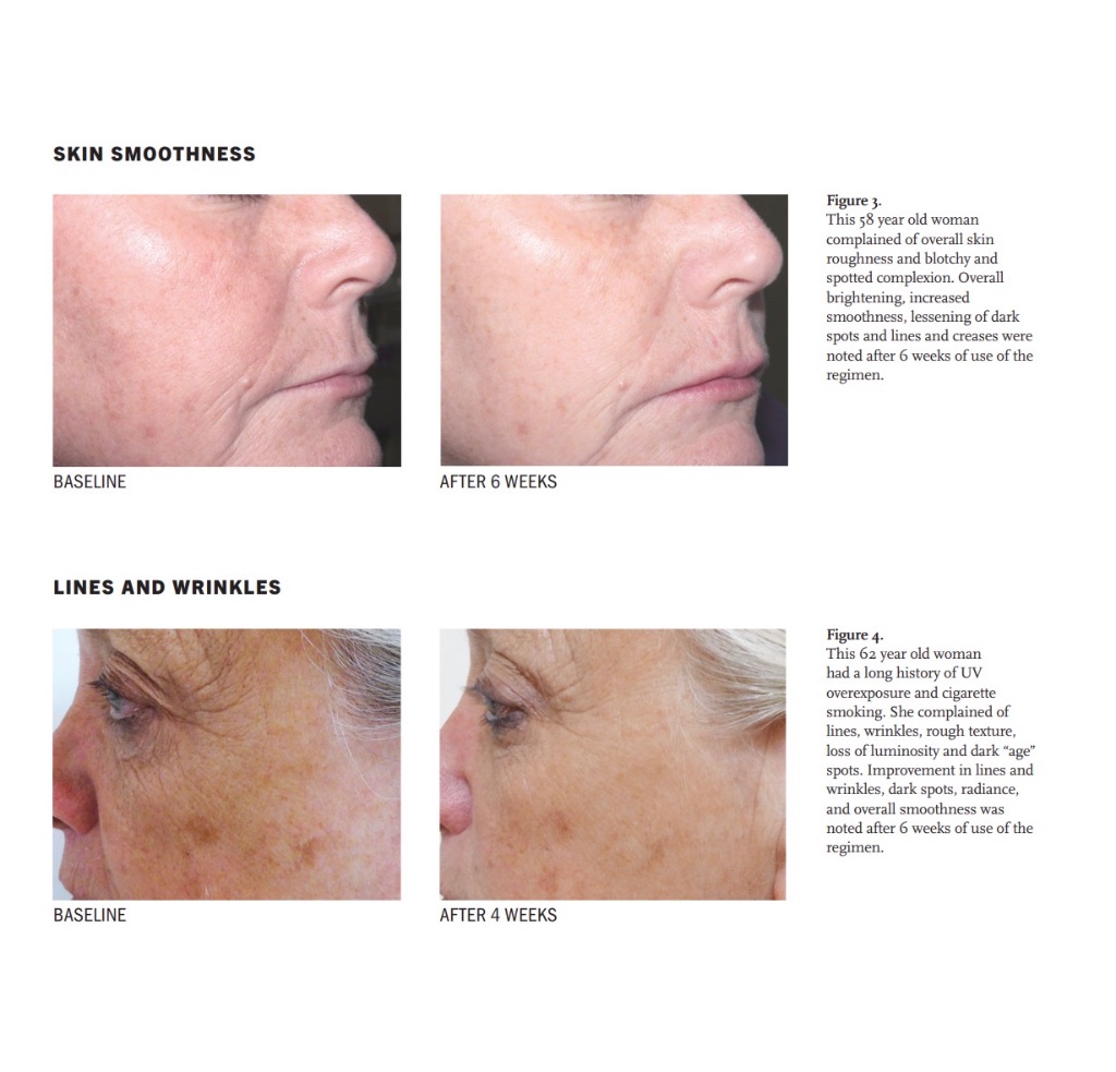 Clinical before and after results — figure 2