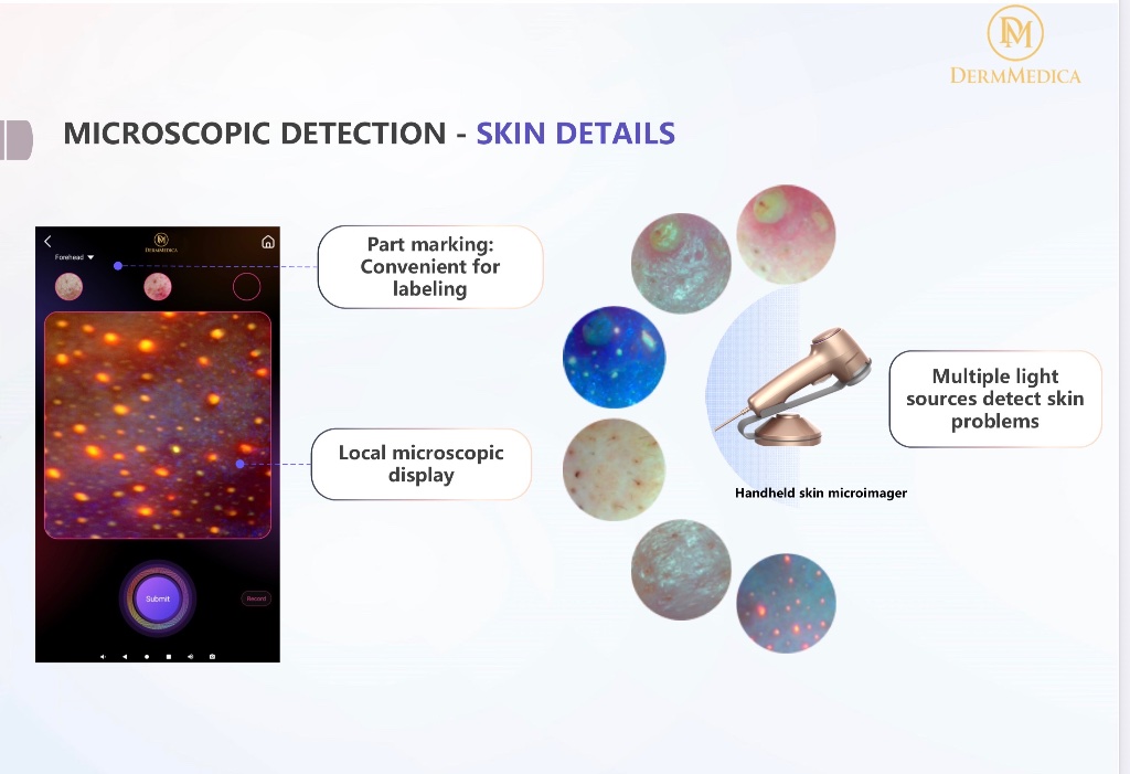 Handheld microimager with multiple light source detection