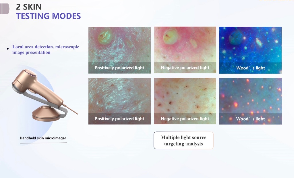 Handheld skin microimager and microscopic detection