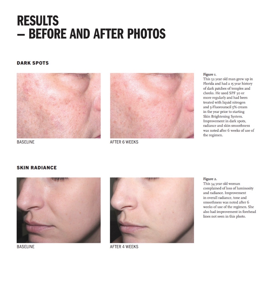 Clinical before and after results — figure 1