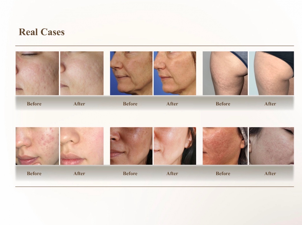 Real cases before and after results