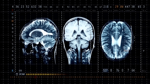 Diagnostic MRI brain scan console — representing the clinical landscape of the 2e mind