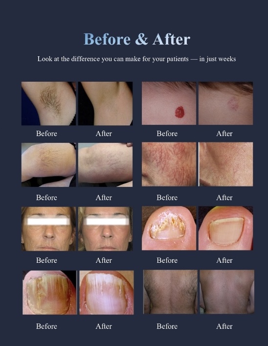 DermMedica VYRA before and after gallery