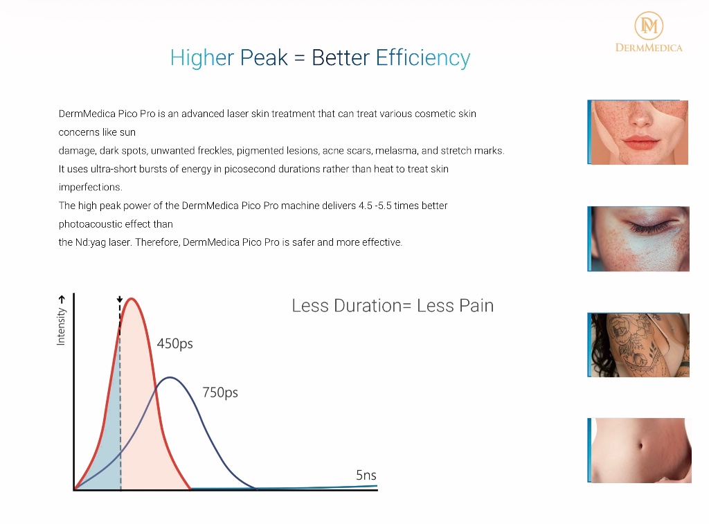 Higher peak power means better efficiency — picosecond vs nanosecond pulse comparison