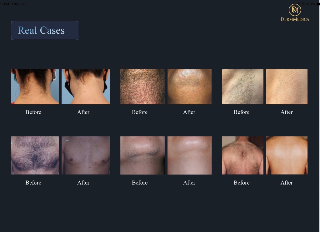 DermMedica VYRA real cases before and after