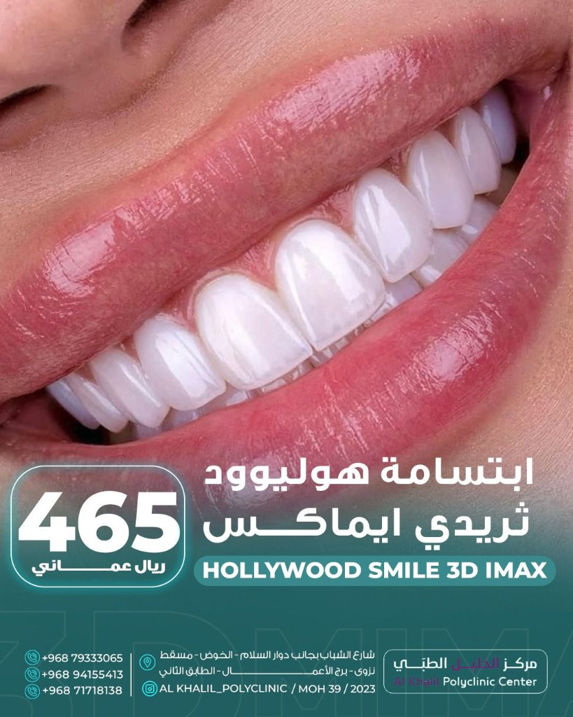 Hollywood Smile result at Alkhalil Dental Center in Muscat, Oman