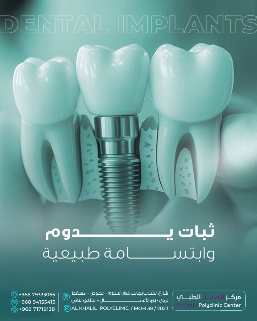 Dental Implants at Alkhalil Dental Center in Muscat, Oman