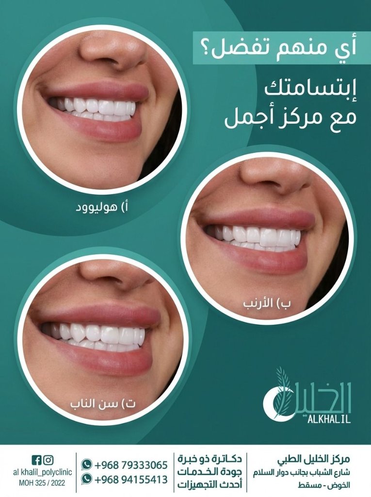Hollywood Smile transformation at Alkhalil Dental Center in Muscat, Oman