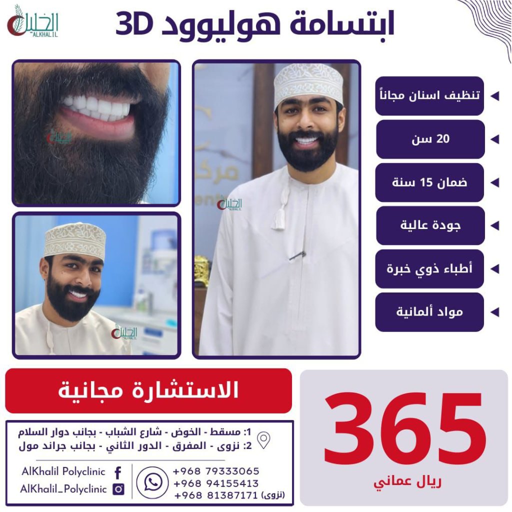 Hollywood Smile result at Alkhalil Dental Center in Muscat, Oman