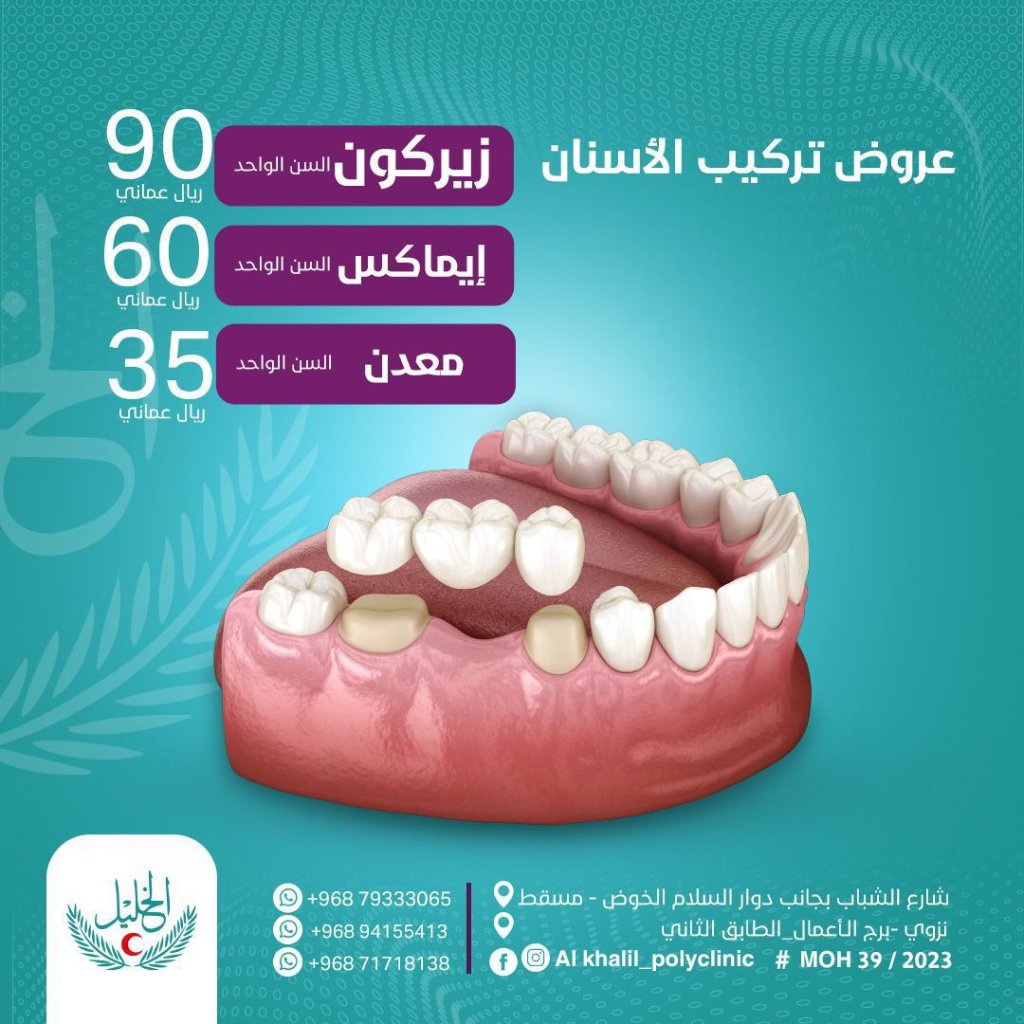 Dental restoration options at Alkhalil Dental Center in Muscat, Oman