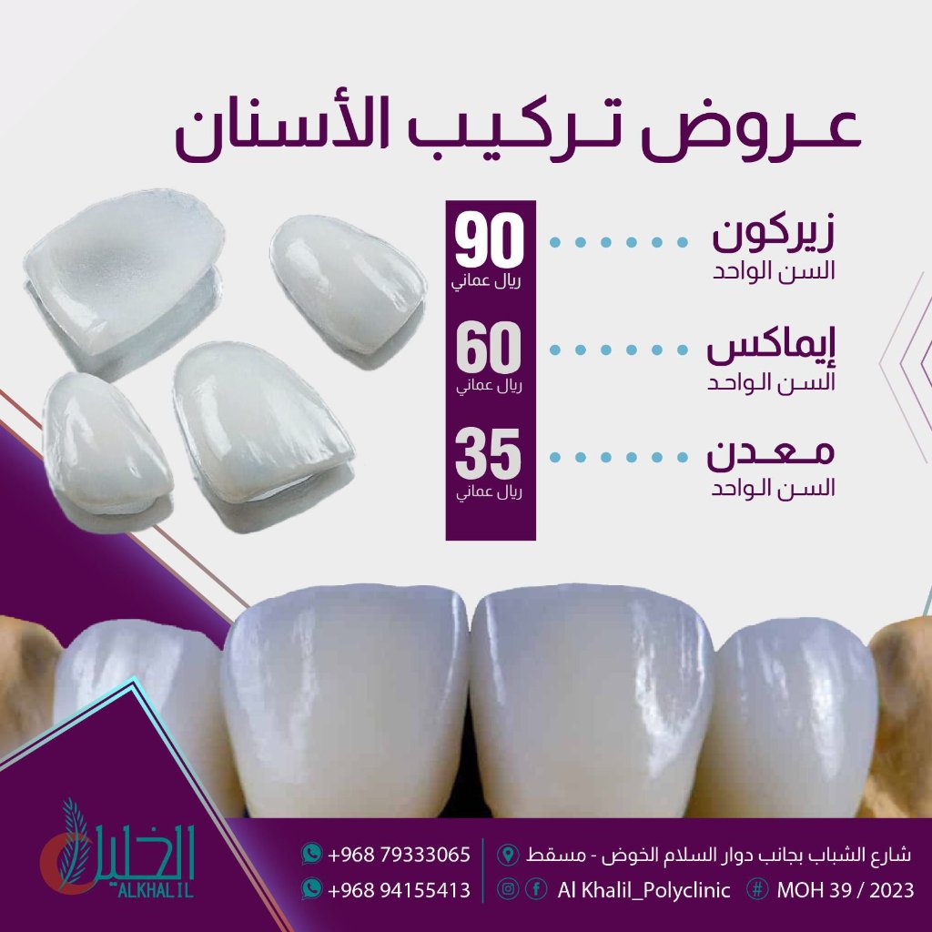 Emax Veneers result at Alkhalil Dental Center in Muscat, Oman
