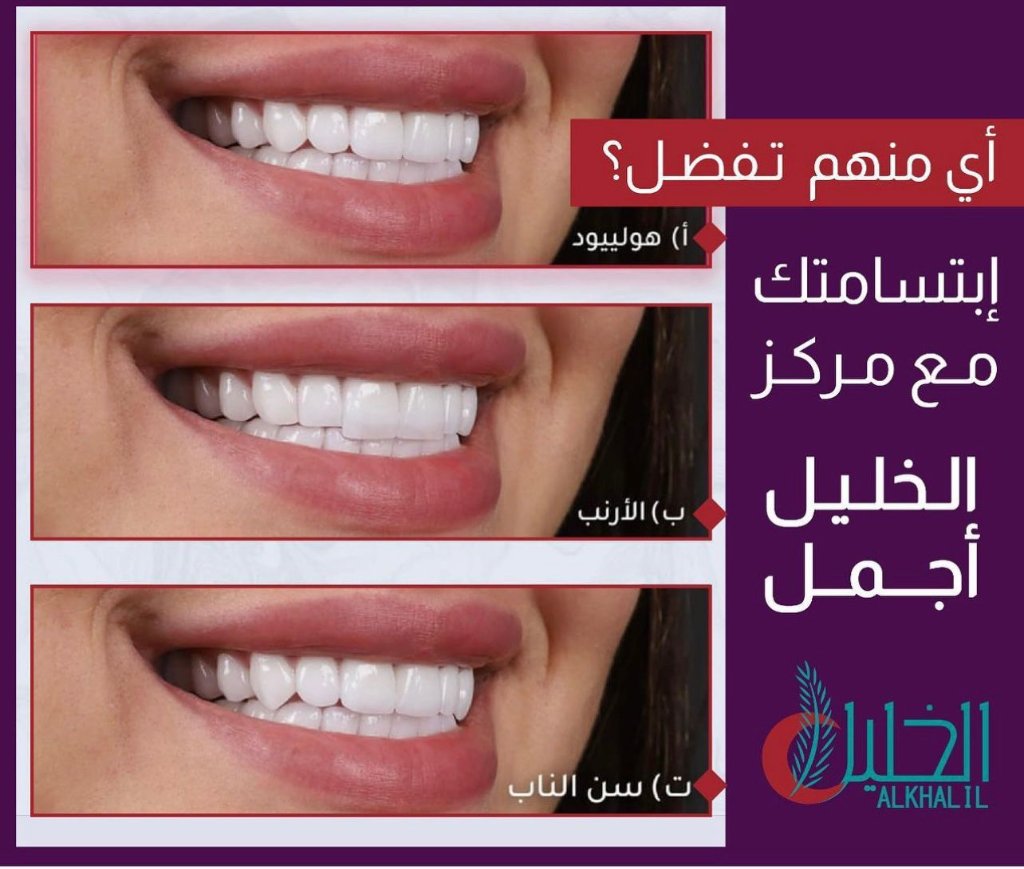 Smile design options showcased at Alkhalil Dental Center in Muscat, Oman