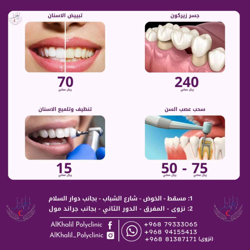 Teeth whitening service at Alkhalil Dental Center in Muscat, Oman