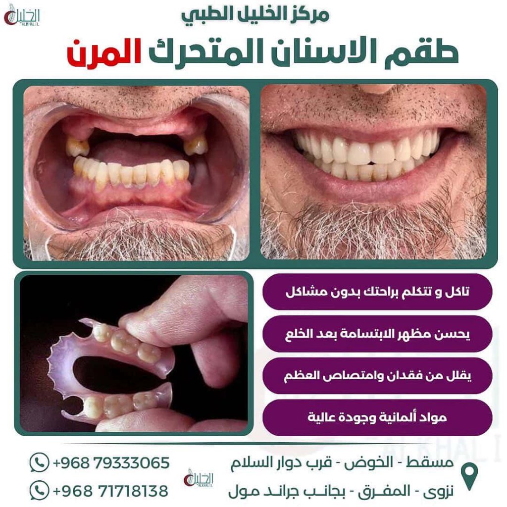 Dental implant case study at Alkhalil Dental Center in Muscat, Oman