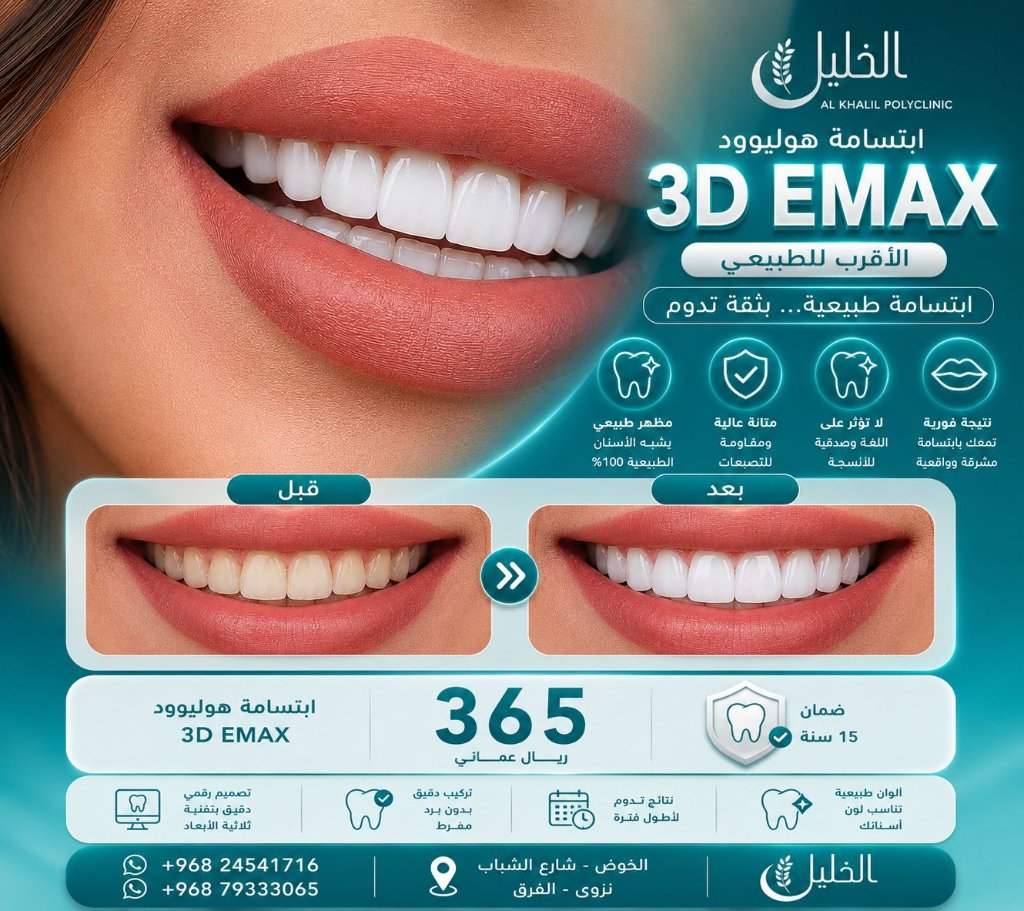 Emax Veneers result at Alkhalil Dental Center in Muscat, Oman