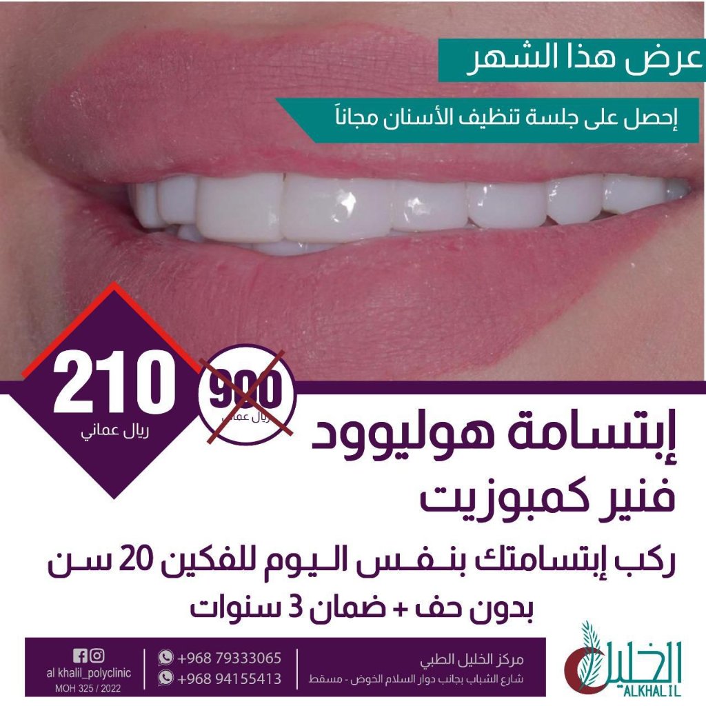 Emax Veneers at Alkhalil Dental Center in Muscat, Oman