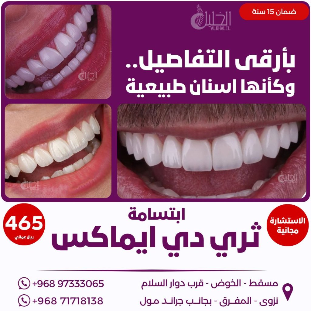 Emax veneers result at Alkhalil Dental Center in Muscat, Oman