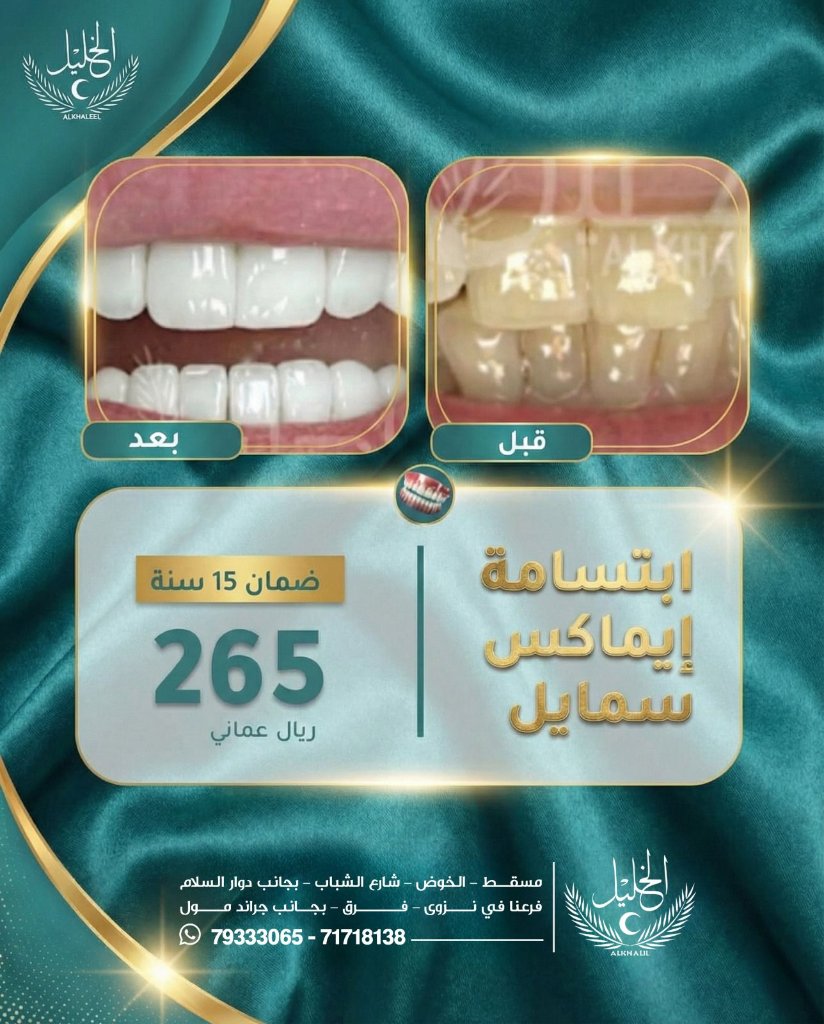 Hollywood Smile transformation at Alkhalil Dental Center in Muscat, Oman