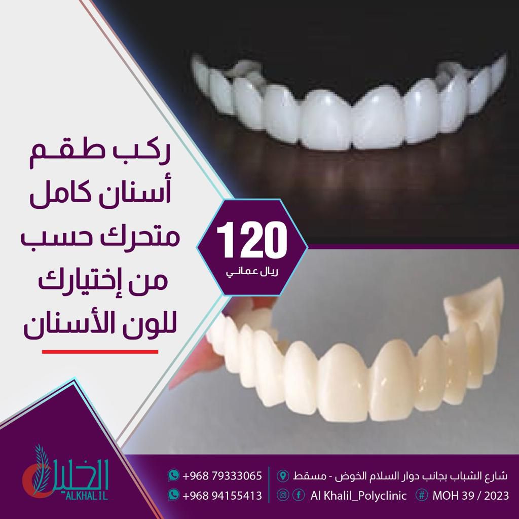 Complete dentures service at Alkhalil Dental Center in Muscat, Oman