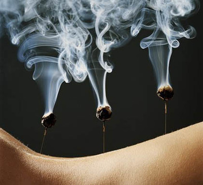 Cupping