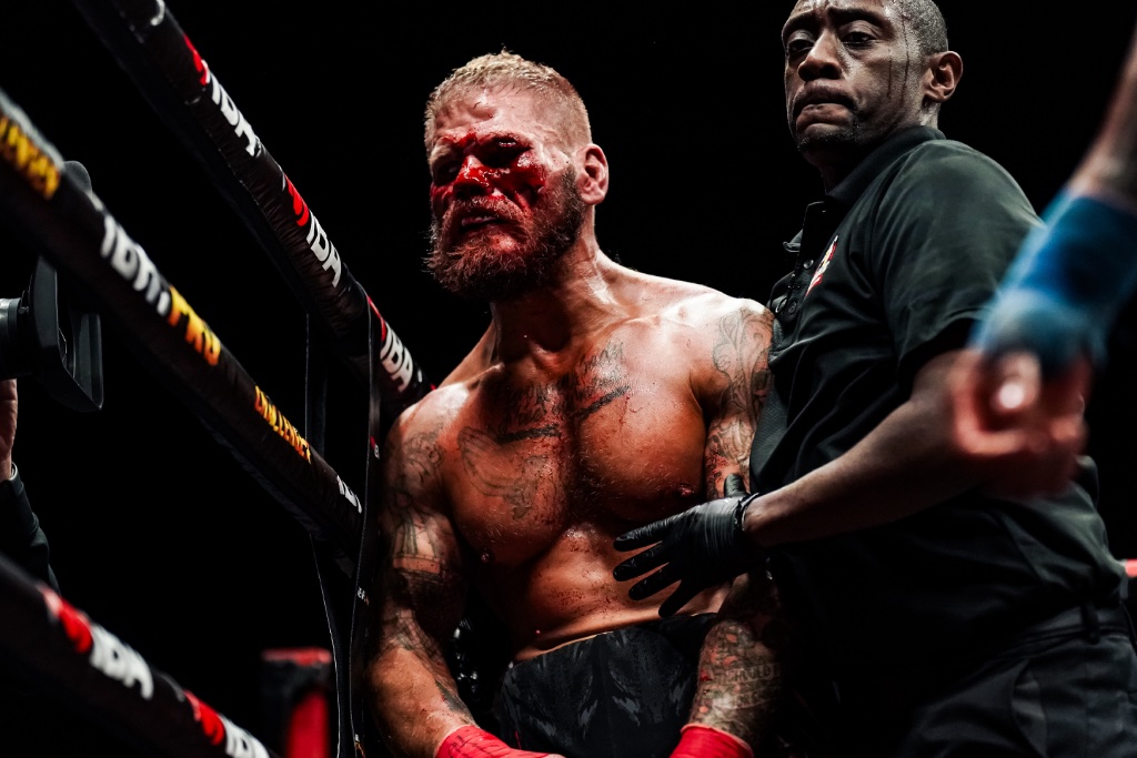 Battle scars — IBA Bare Knuckle Miami