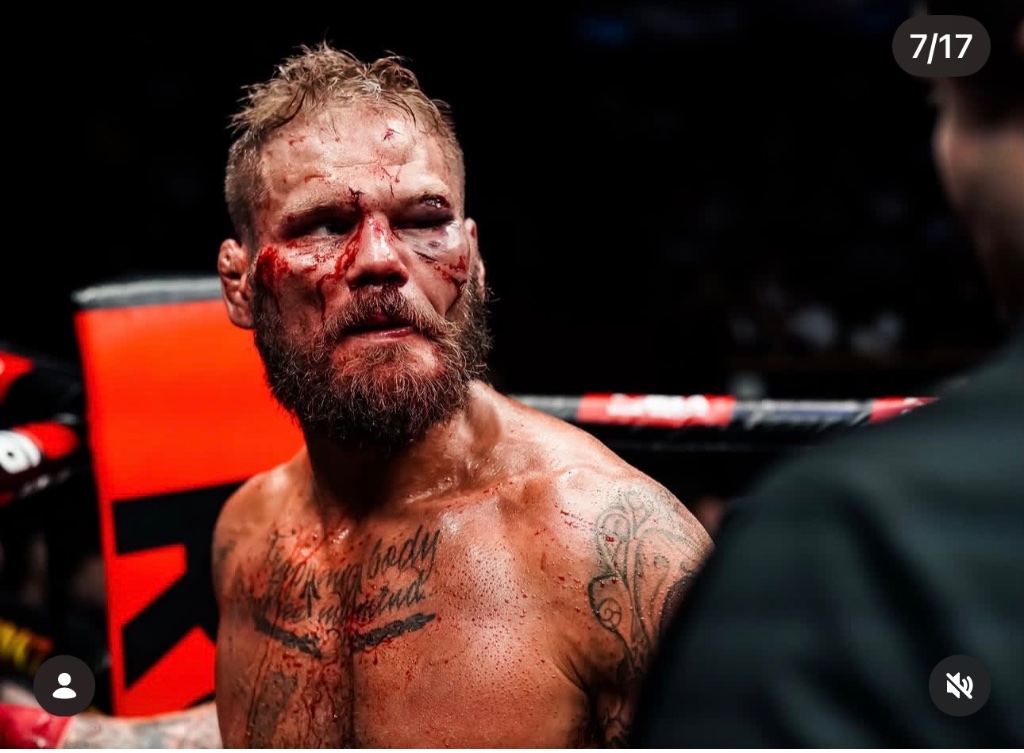 Warrior — bare knuckle battle scars