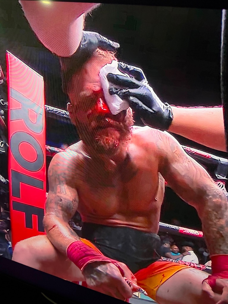 Fight corner