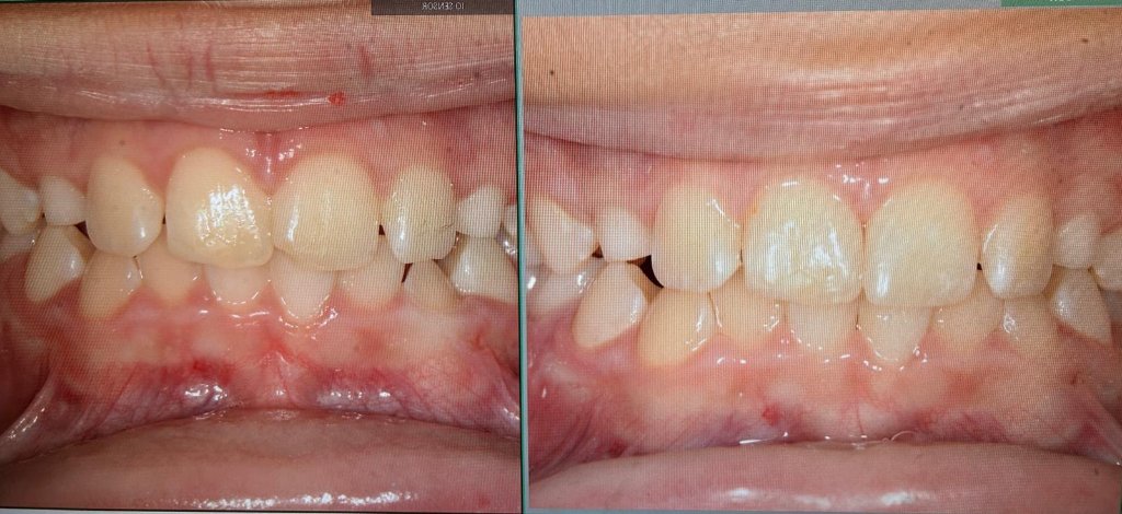 Cosmetic Enhancement — before and after dental transformation