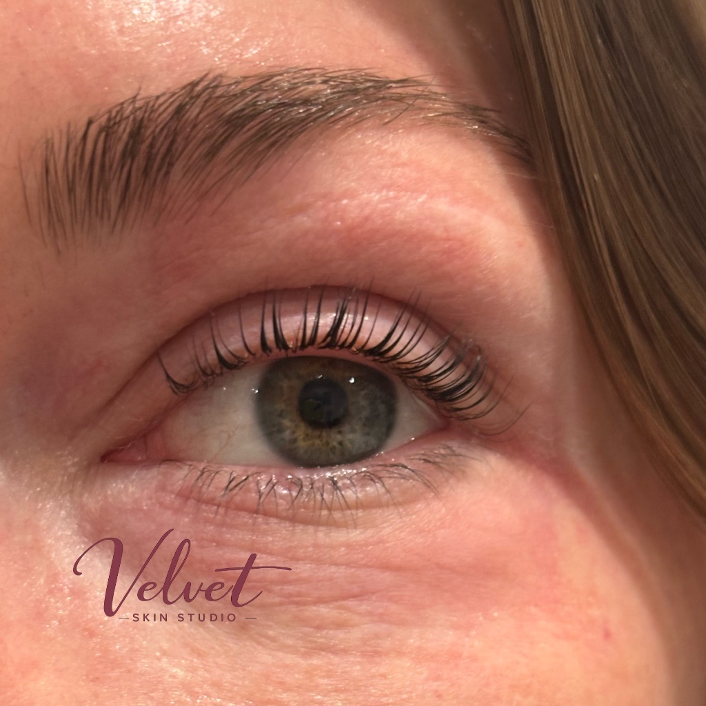 Lash lift result