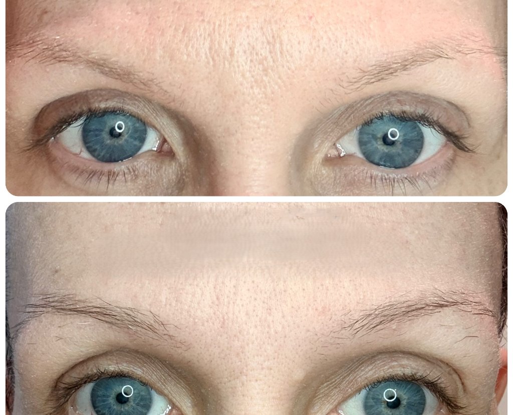 Before and after results
