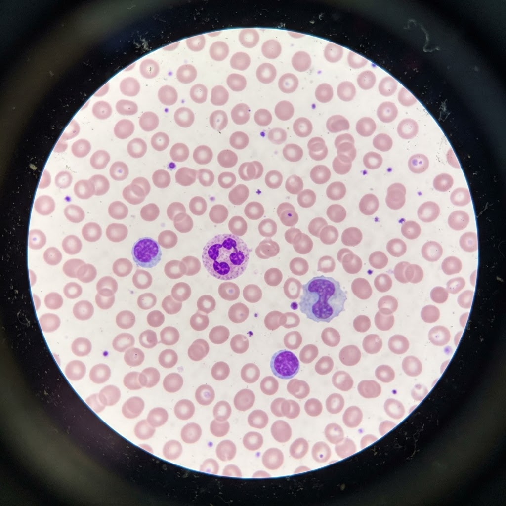 Human Blood Smear