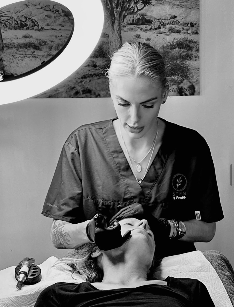 Microneedling