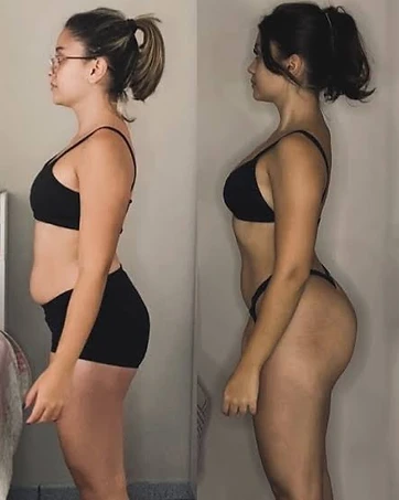 Transformação de Camila — antes e depois