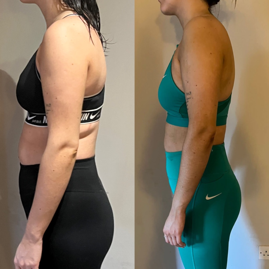 Louise — confidence regained