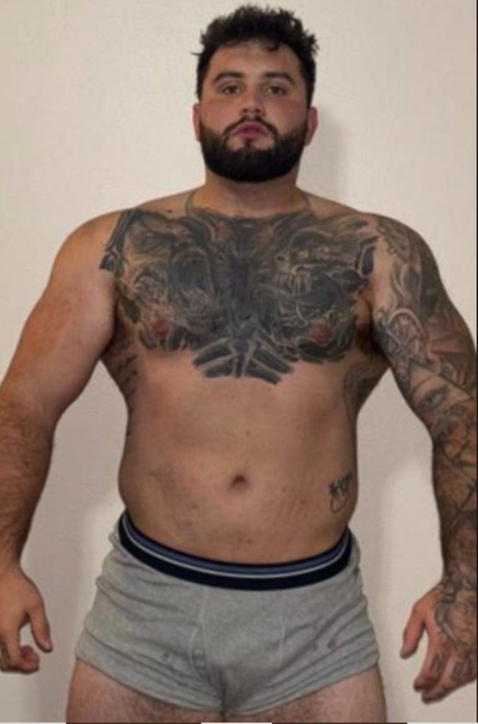 Anthony after