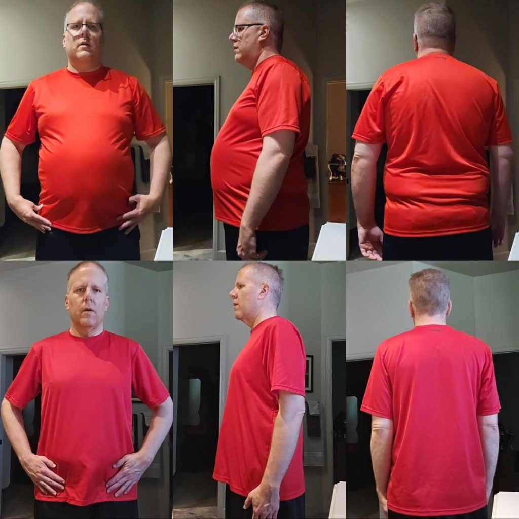 Brian — before & after