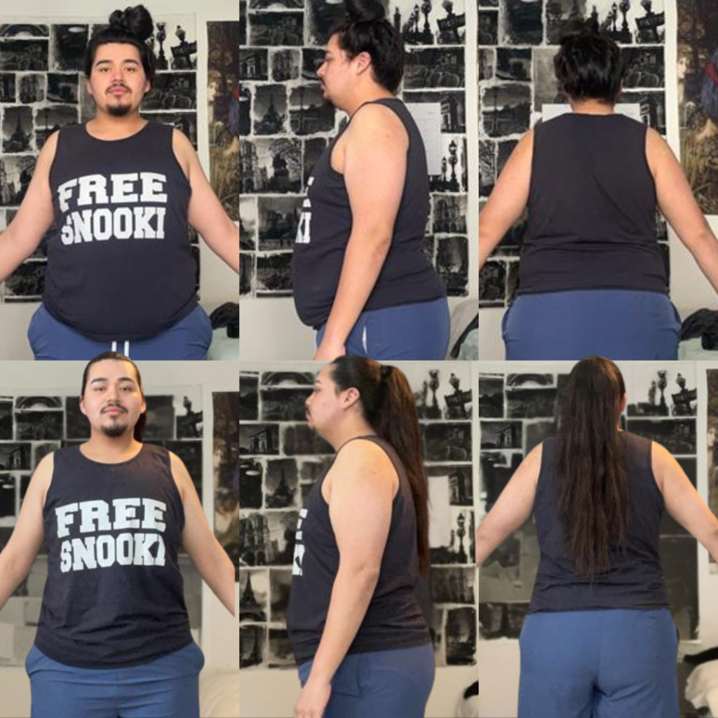 Esteban — before & after