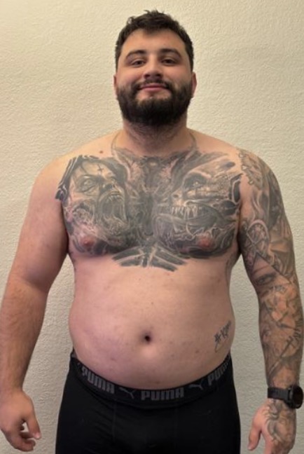 Anthony before