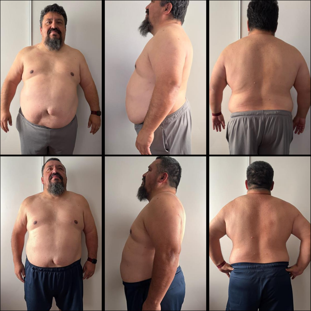 Hugo — before & after