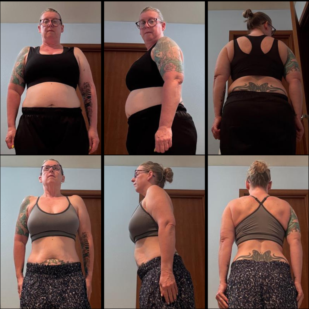 Stacy — before & after
