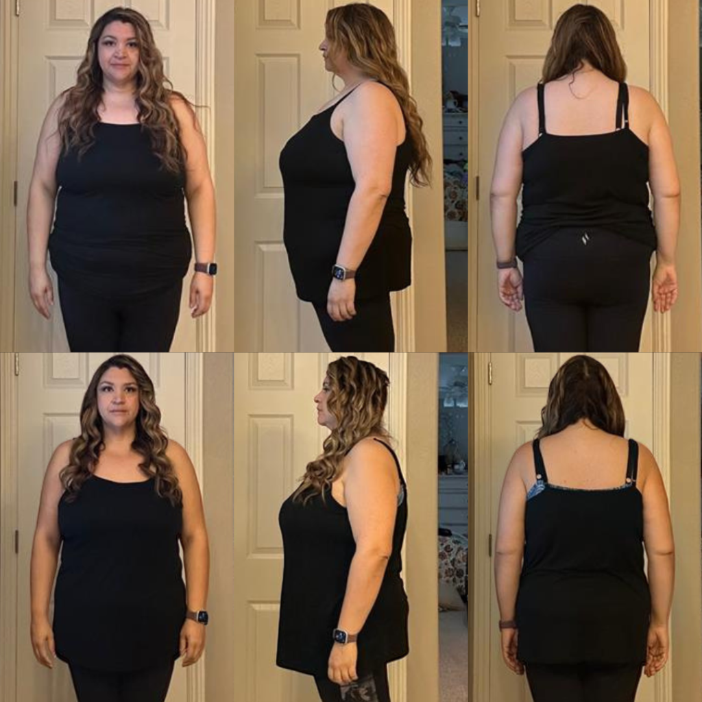 Krishelle — before & after