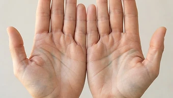 Open human palms showing the unique pattern of veins, lines and texture