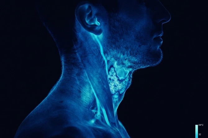 Perfil tiroideo: el termostato del metabolismo